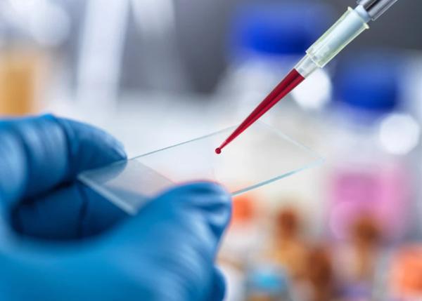 Xét nghiệm máu đầu tiên phát hiện chứng mệt mỏi mãn tính