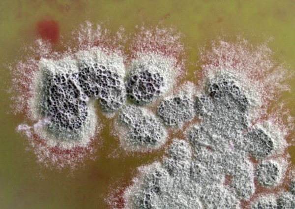 Kháng sinh có thể tiêu diệt siêu vi khuẩn được phát hiện trong vi khuẩn đất