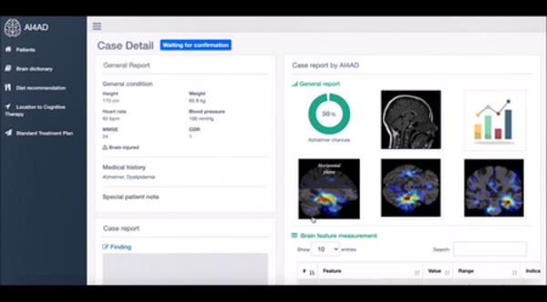 Tiến sĩ tạo phần mềm AI chẩn đoán bệnh Alzheimer trong 10 phút