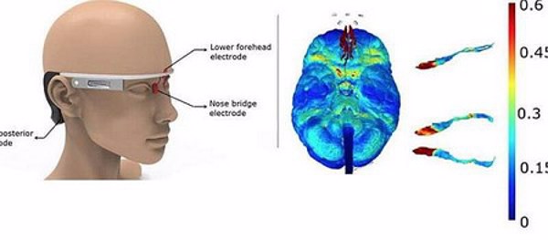 Nghiên cứu mới giúp ngăn chặn bệnh Alzheimer