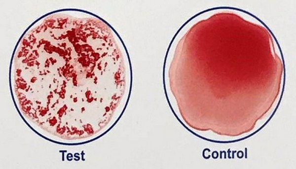 Xét nghiệm máu nhanh trong vài phút xác định ai đã tiêm chủng vắc xin COVID-19