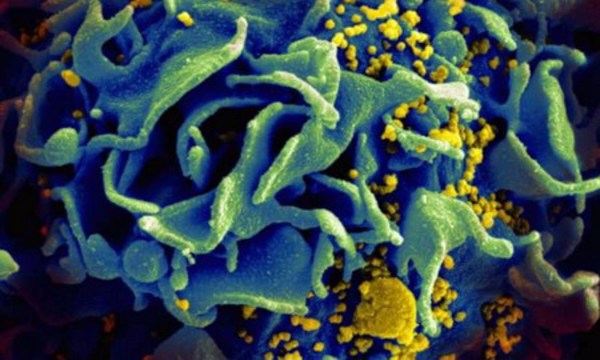 Phát triển phân tử nano ngăn ngừa lây nhiễm virus HIV