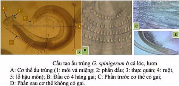 Nghiên cứu một số đặc điểm dịch tễ, lâm sàng, cận lâm sàng của bệnh giun đầu gai ở người tại một số điểm miền Trung - Việt Nam