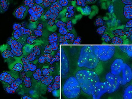 Các telomere dưới kính hiển vi huỳnh quang. Sự phân bố chiều dài của telomere (ảnh lớn: màu đỏ; ảnh nhỏ: màu xanh lá cây nhạt).