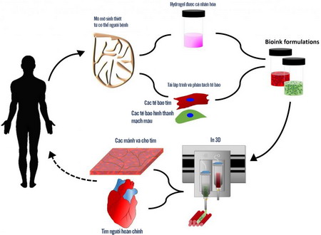 Quy trình in các mảnh vá cho tim và trái tim 3D hoàn chỉnh